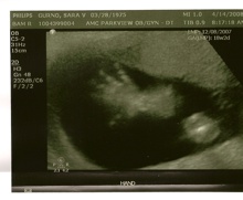 sonogram sonogram